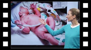 Graviditet og fødsel.