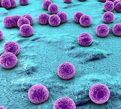 Stafolykokker på hud