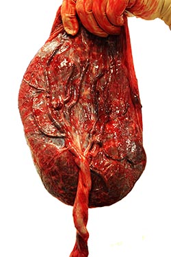 shutterstock_124845277 sex moderkage 250px