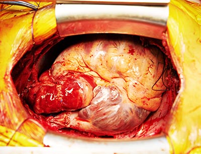 shutterstock_176956055 hjerte