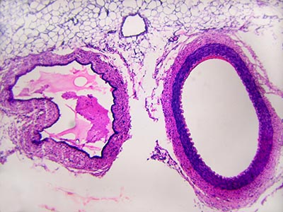 shutterstock_8164006 blod aterie vene