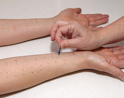 shutterstock_97259696 immun allergi