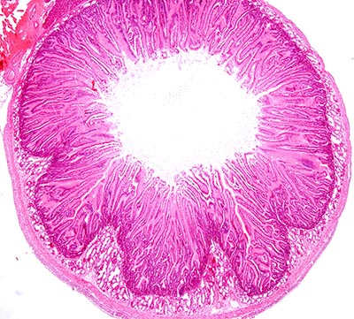 shutterstock_159810491 tynd tarm fordøjelsen