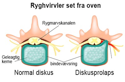 shutterstock_194330852 nerver vertebra 400px